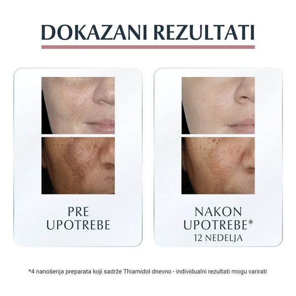 Eucerin Anti-pigment noćna krema 50ml