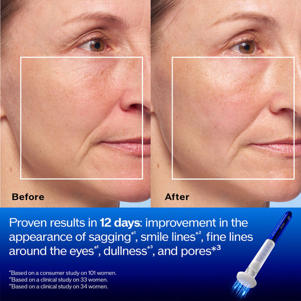 Shiseido Bio-Performance Micro-Click Concentrate