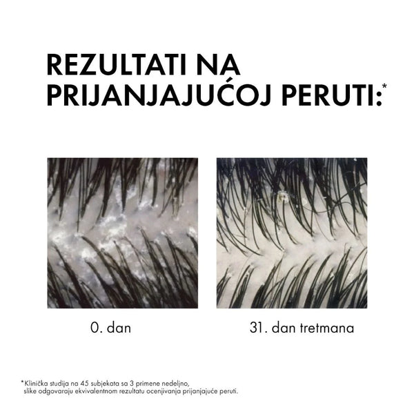 Vichy Dercos Anti - Dandruff Šampon protiv peruti za normalnu do masnu kosu, 200 ml