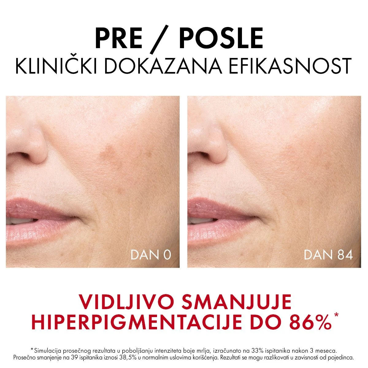 Vichy liftactiv pigment specialist B3 serum protiv hiperpigmentacijskih fleka, 30 ml