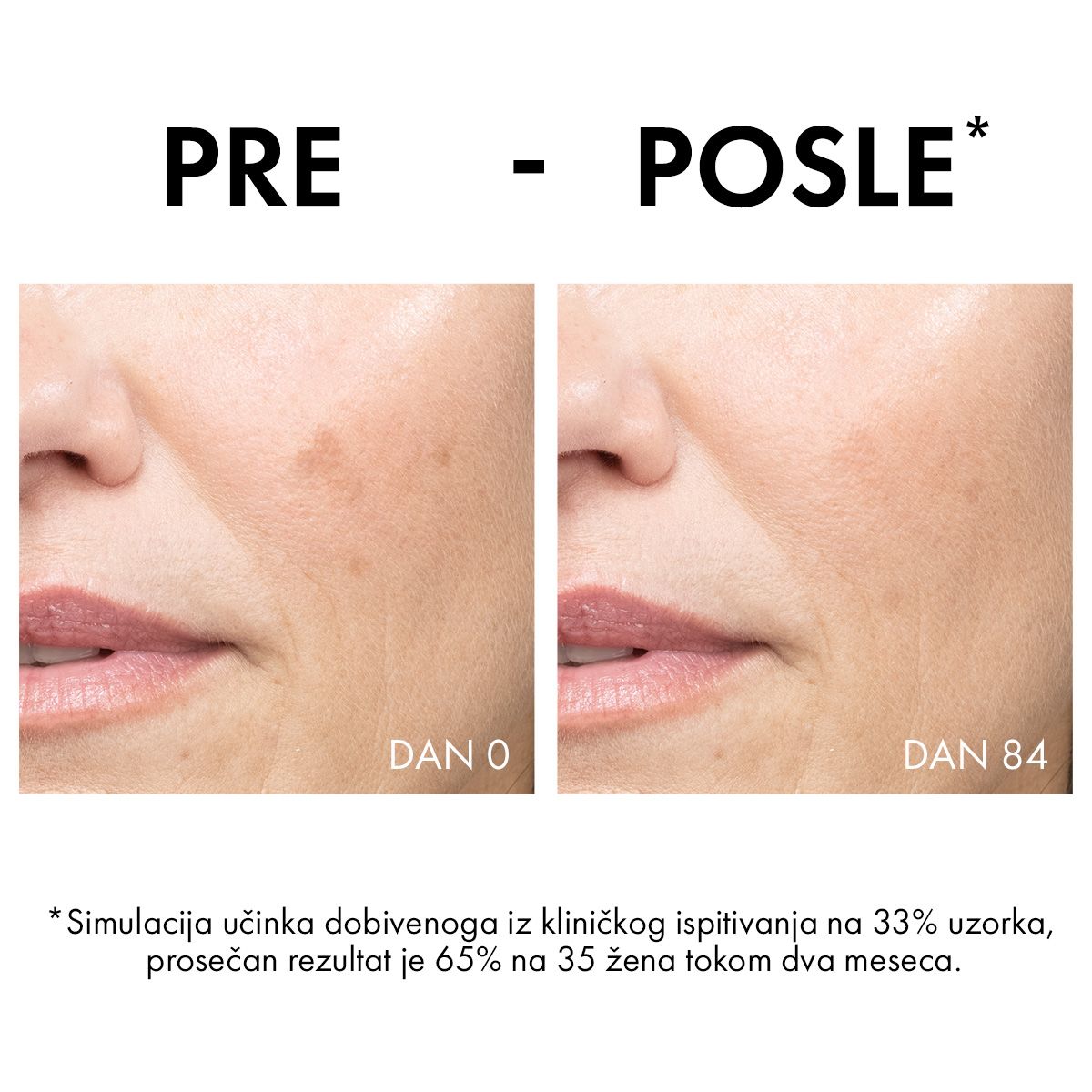 Vichy Liftactiv B3 krema protiv hiperpigmentacijskih fleka i bora SPF 50, 50ml