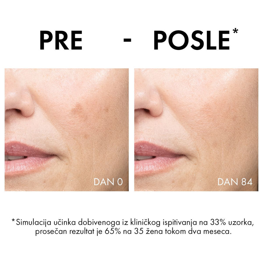 Vichy Liftactiv B3 krema protiv hiperpigmentacijskih fleka i bora SPF 50, 50ml
