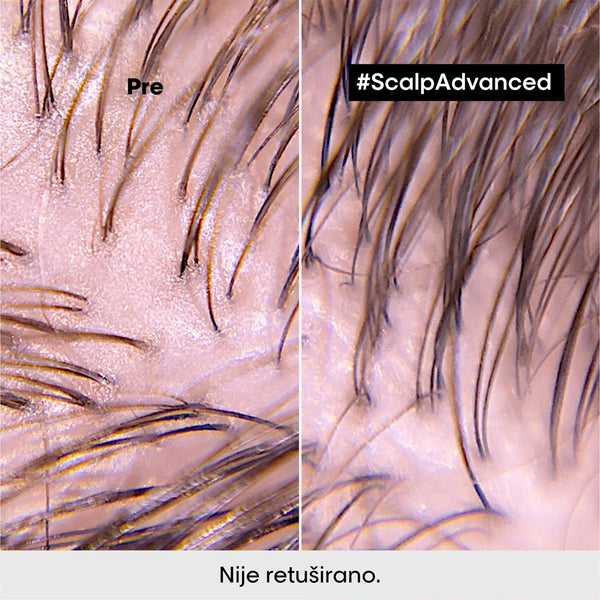 L'Oréal Professionnel Scalp Advanced maska od gline za masan skalp 250ml