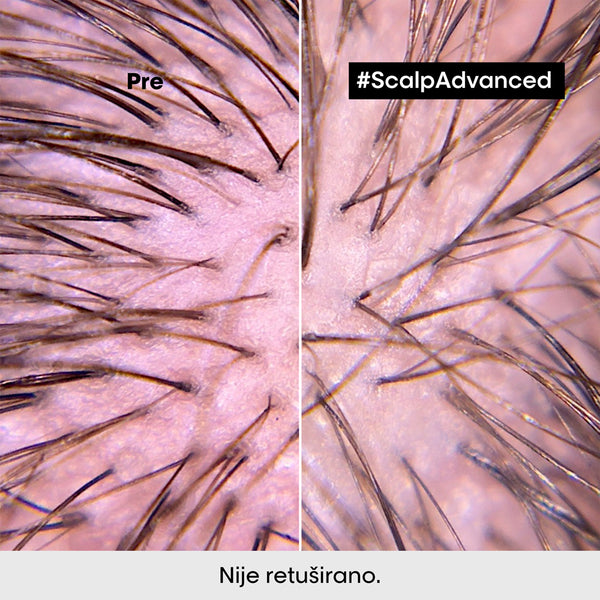 L'Oréal Professionnel Scalp Advanced regenerator za osetljiv skalp 200ml