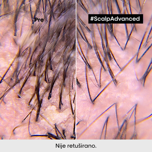 L'Oréal Professionnel Scalp Advanced šampon protiv peruti 300ml