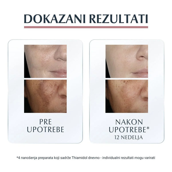 Eucerin Anti-Pigment serum  30ml