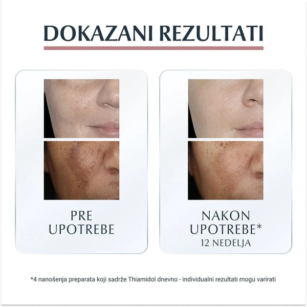 Eucerin Anti-pigment korektor 5ml