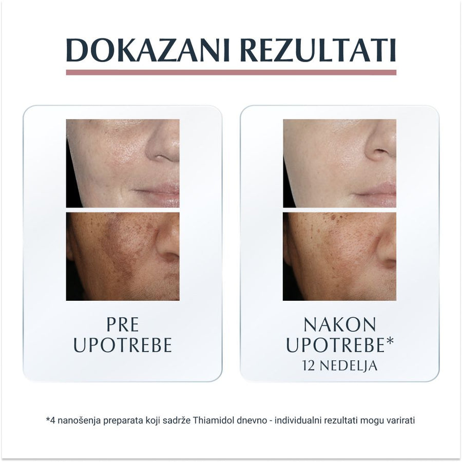 Eucerin Anti-pigment dnevna krema spf 30 50ml