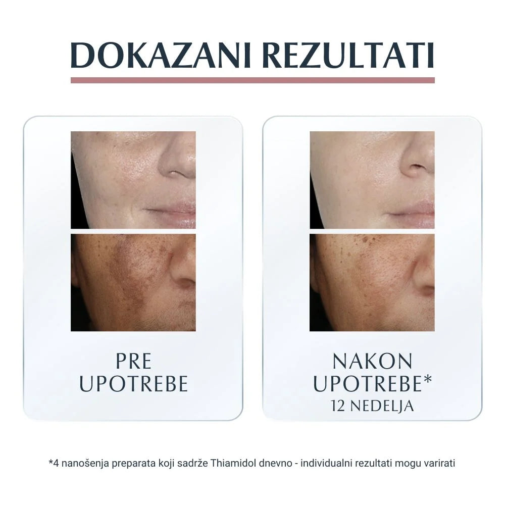 Eucerin Anti-pigment noćna krema 50ml