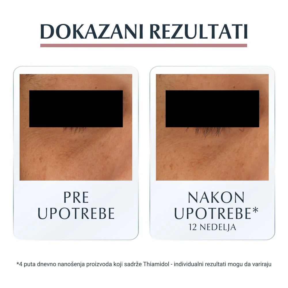 Eucerin Anti-Pigment Krema za tamne kolutove oko očiju 15ml