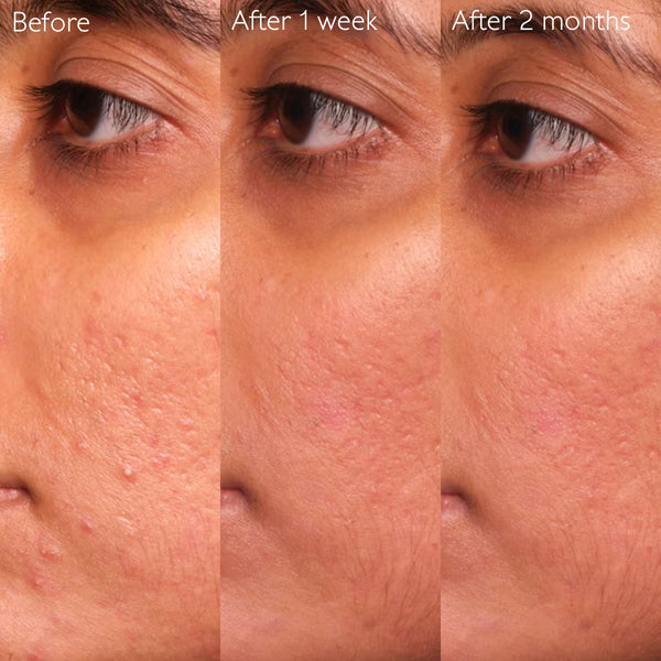 Caudalie Vinopure Serum