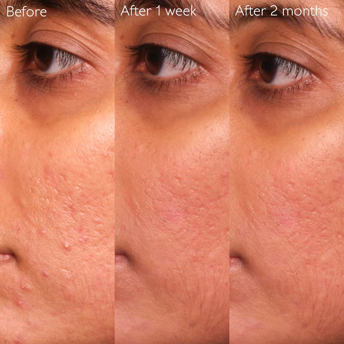 Caudalie Vinopure Serum