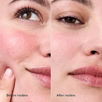 Clinique Redness Solution Daily Relief Cream 50ml