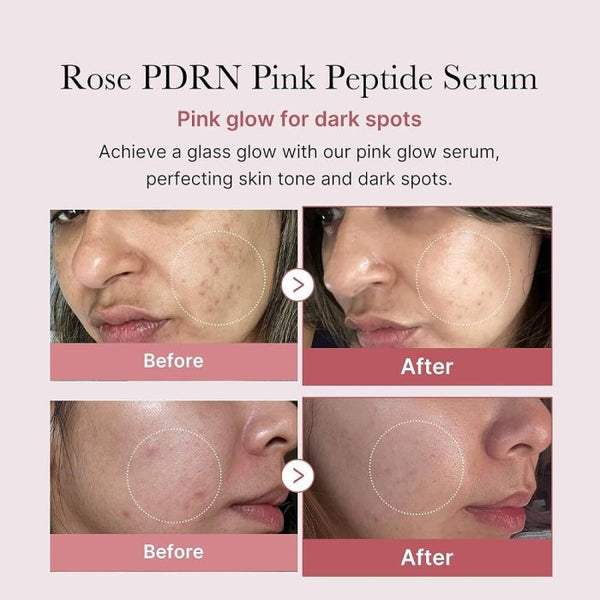 Medicube 10EA PDRN Pink One Day Serum