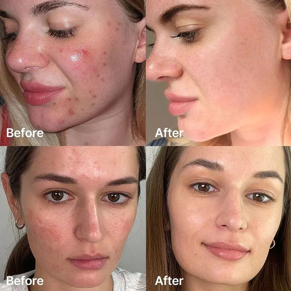 Medicube Red Succinic Acid Clarifying Serum