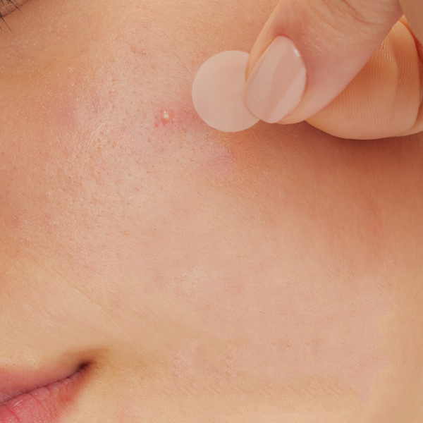 CeraVe Acne Control Patch