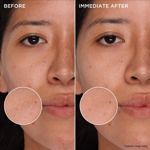Benefit The POREfessional Deep Retreat